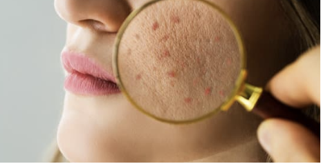 마이크로바이옴 스킨케어 (피부 장벽, 유익균, 피부 건강) 설명글