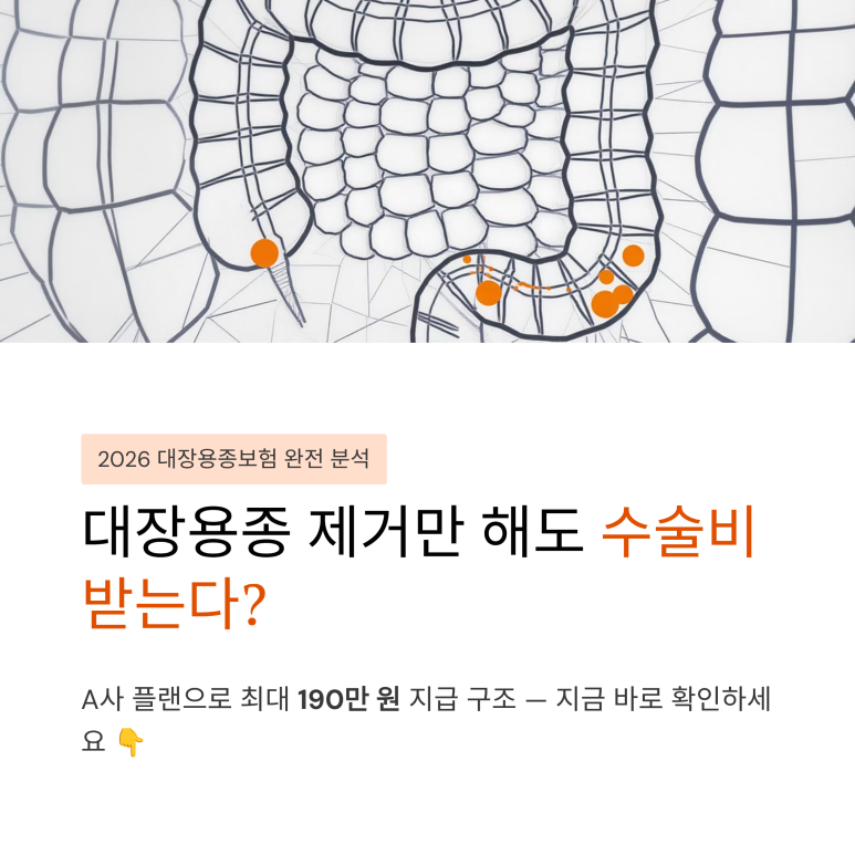 대장내시경 검사 중 진행되는 대장용종 제거 과정
