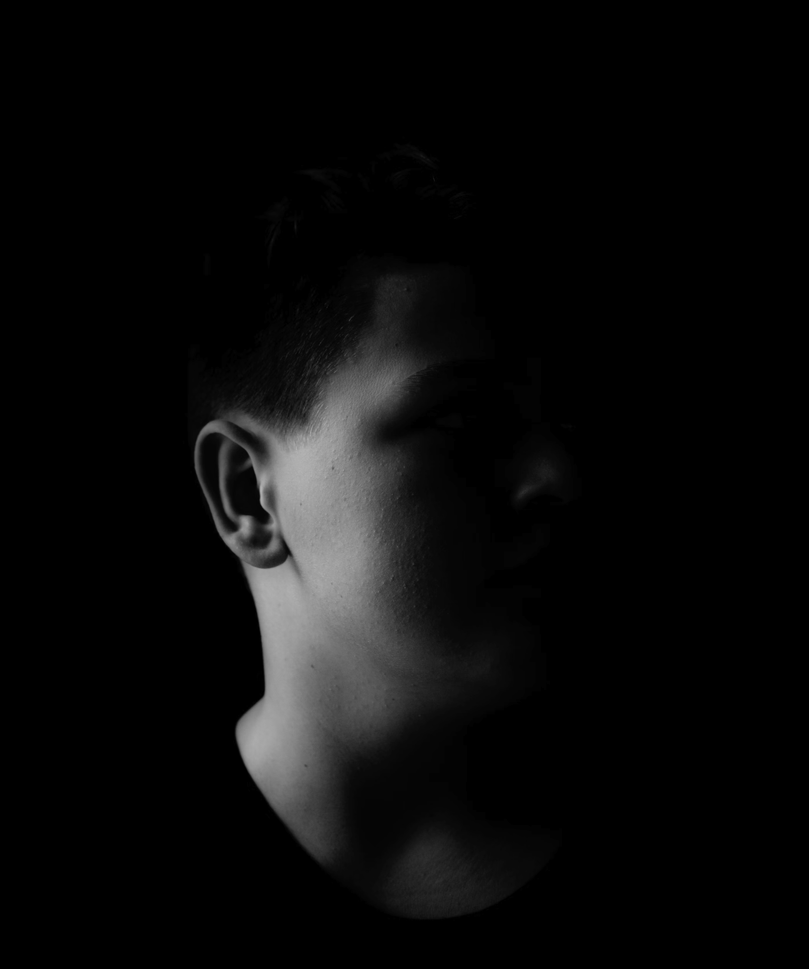 이석증 자가치료법