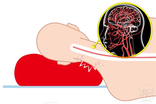 수명단축 잠자는 습관 베개높이