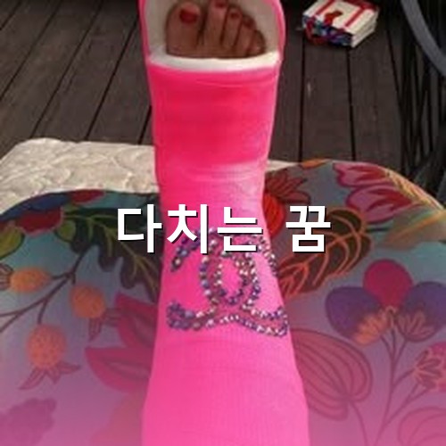 다리를-다쳐-구찌가-수놓아진-분홍색-깁스를-하고있는-모습