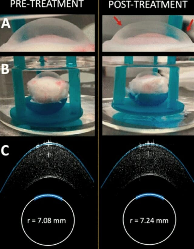 EMR 치료 전후 토끼 각막, 각막 곡률이 바뀌었다.