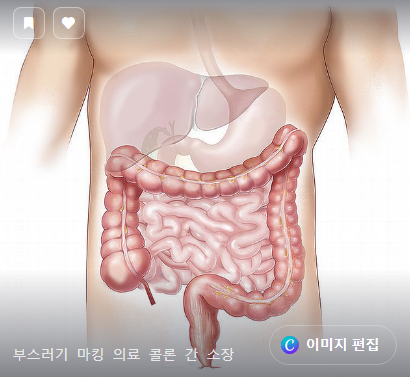 장 건강이 모든 건강의 시작인 이유