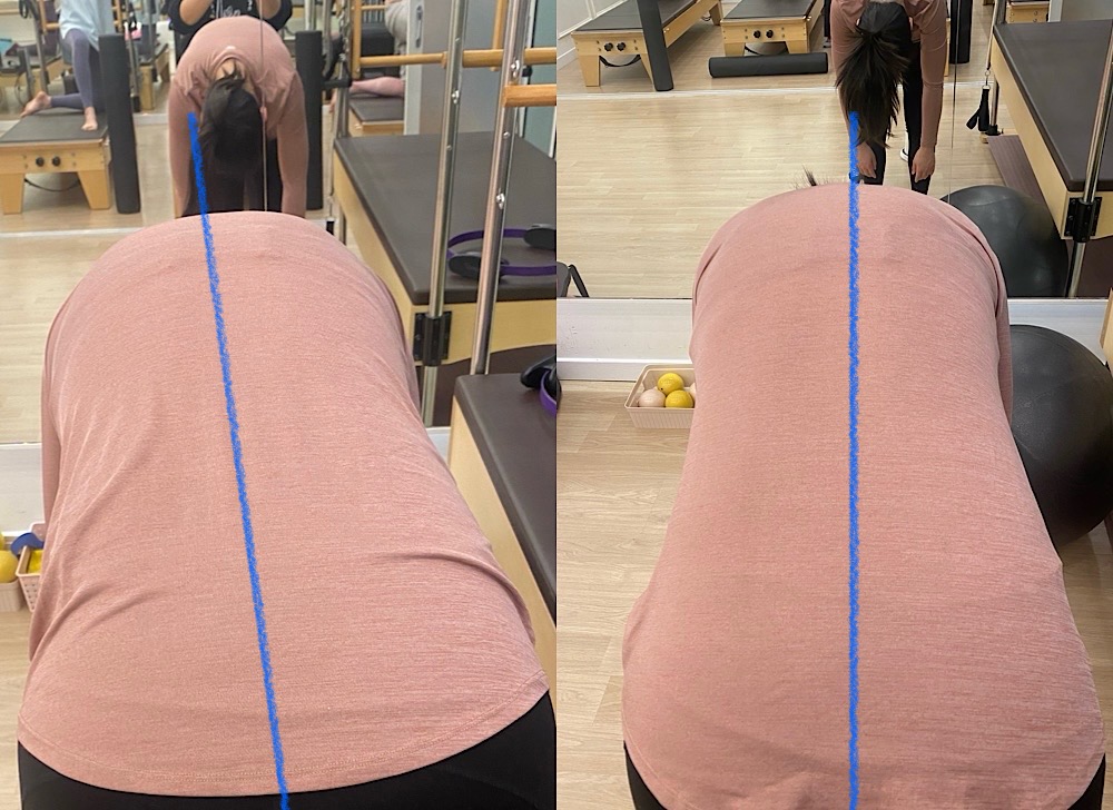 허리디스크 환자를 위한 필라테스, 정말 효과가 있을까?