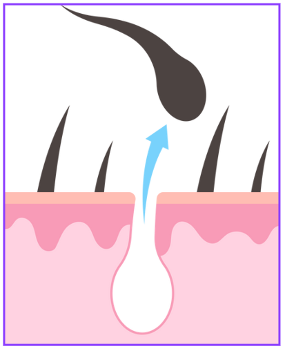 모낭염 원인과 치료방법