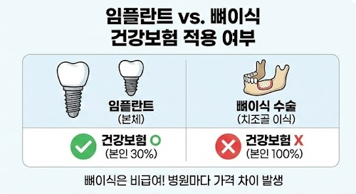 임플란트 뼈이식 건강보험