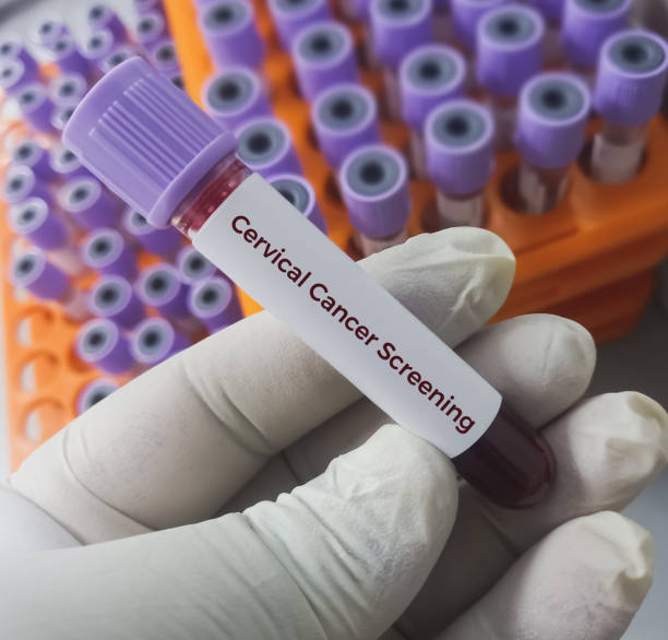 자궁경부암 액상세포검사 LBC 조기 진단 세포검사 pap smear HPV 검사 여성 건강 정기 검진 자궁경부 액상 반응성 세포 변화