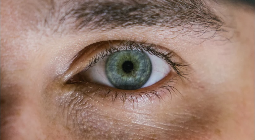 눈밑한관종 생기는 원인 및 해결방법