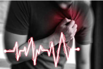 급성 심근경색증