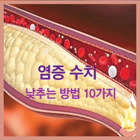 염증 수치 낮추는 방법 10가지