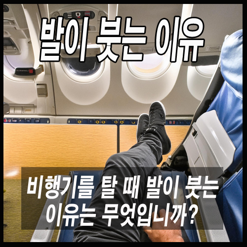 발이 붓는 이유: 비행기를 탈 때 발이 붓는 이유는 무엇입니까?