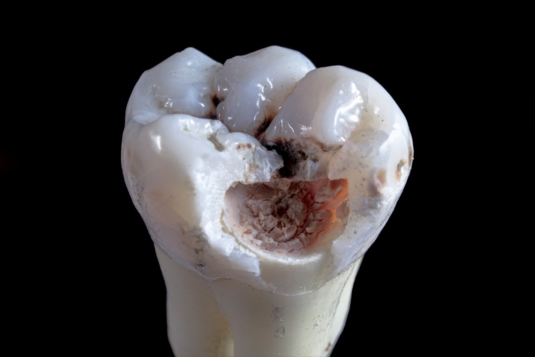 implant