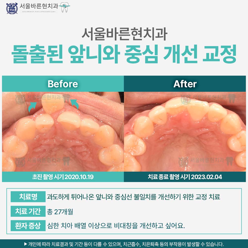 해운대교정치과