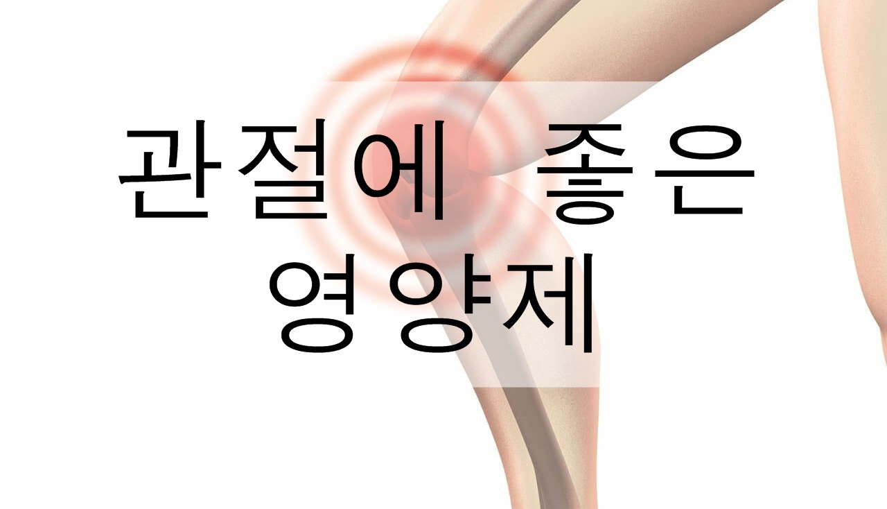 관절에 좋은 영양제 정리! (관절에 좋은 운동&#44; 안 좋은 운동&#44; 습관)