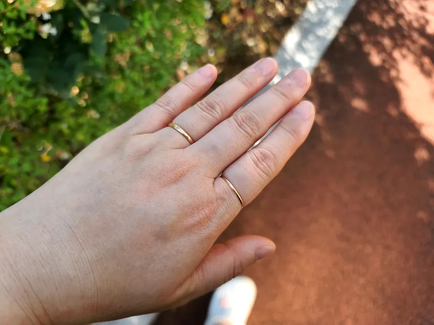 손이 붓는 이유