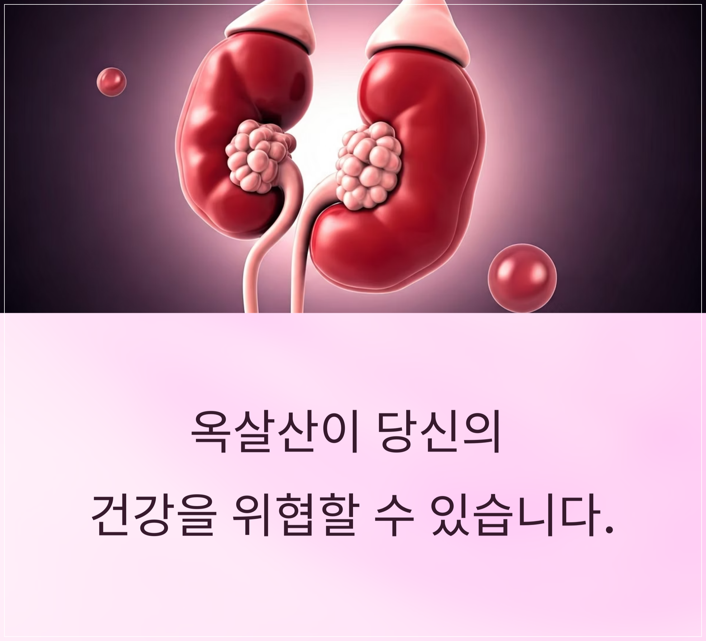 옥살산이 체내에서 결정을 형성하는 원인