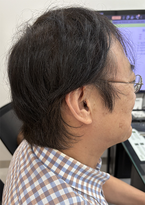 크로스 보청기 착용 고객님