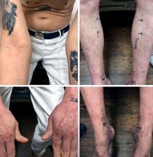 혈관이 안 나와 사형집행이 취소된 사형수