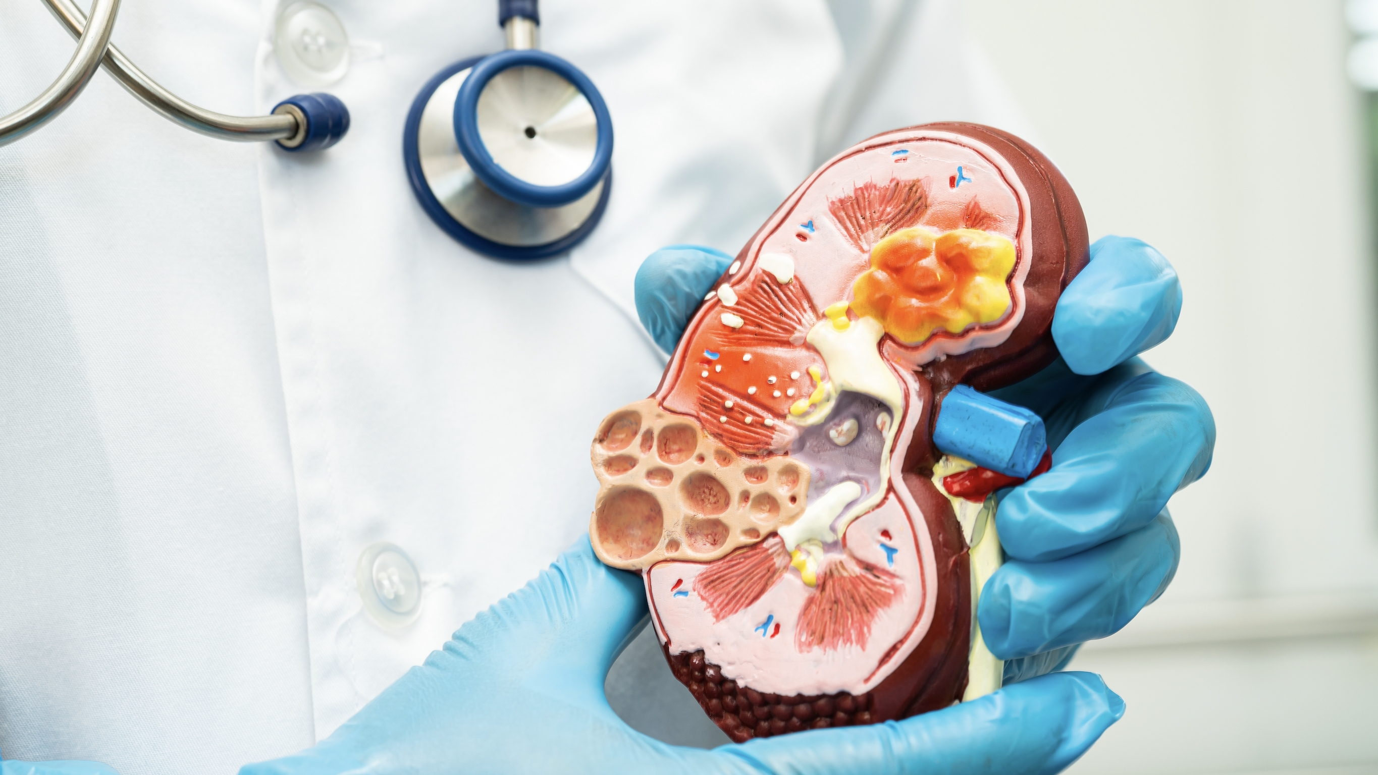 신부전 (Renal Failure)