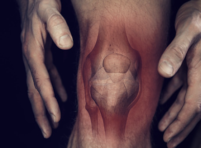 퇴행성관절염 증상 32