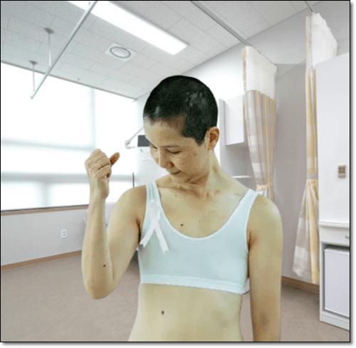 항암 치료 중인 여성