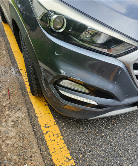 내 차량 사고 사진