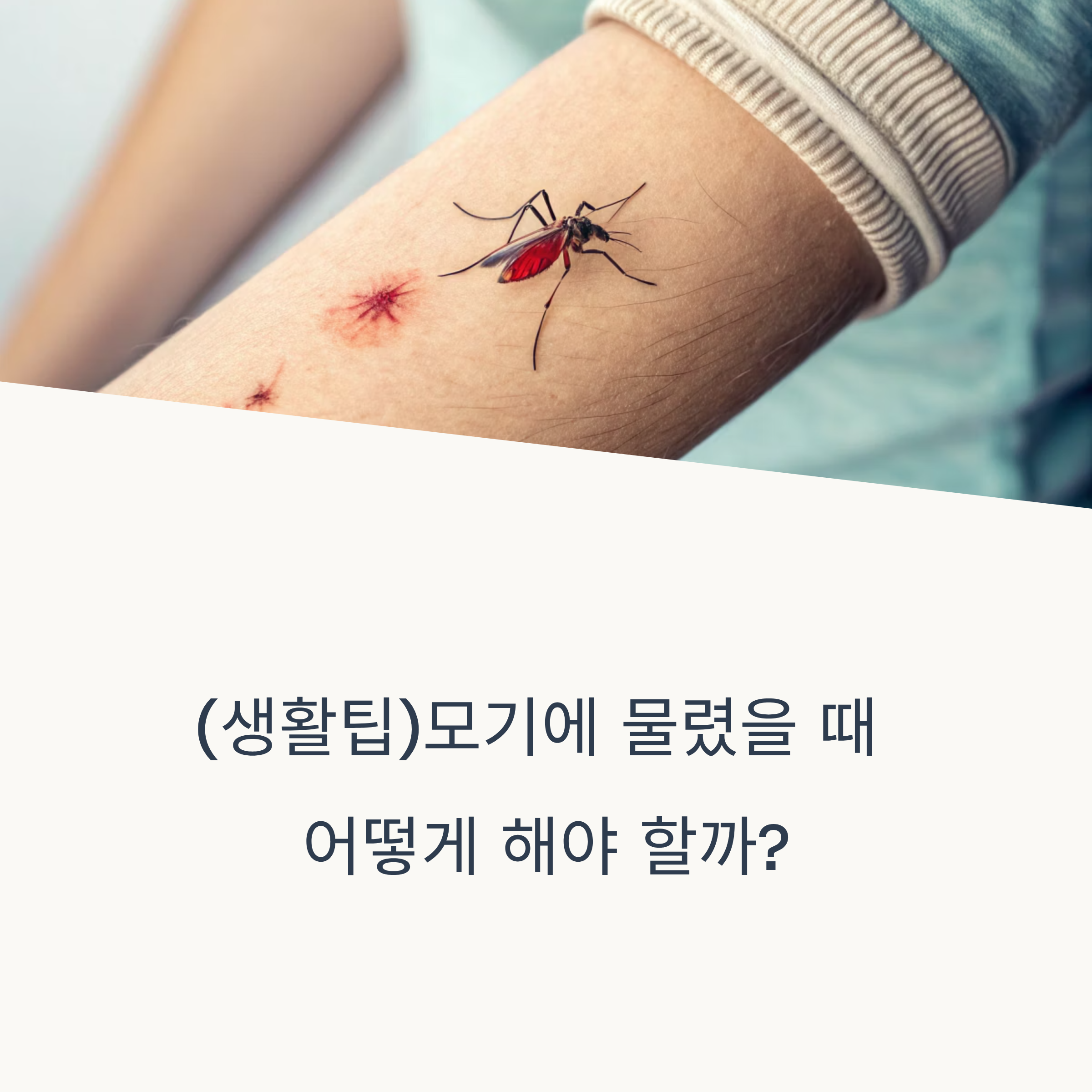 생활팁)모기에 물렸을 때 어떻게 해야 할까?