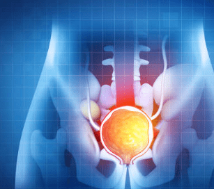 전립선비대증 치료방법 수술비용