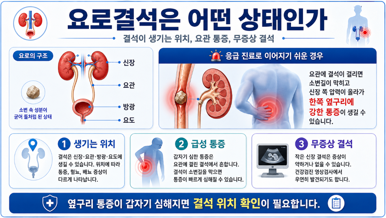 요로결석이 생기는 위치와 요관 통증, 신장 결석, 무증상 결석의 차이를 설명한 의학 자료 이미지