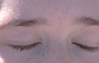 눈썹 이식 비용 가격 부작용