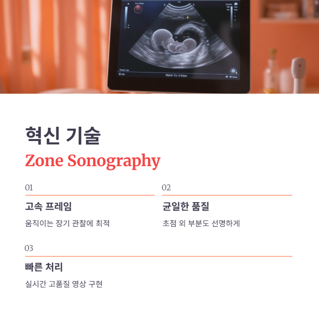 MINDRAY의 독보적인 임상 기술