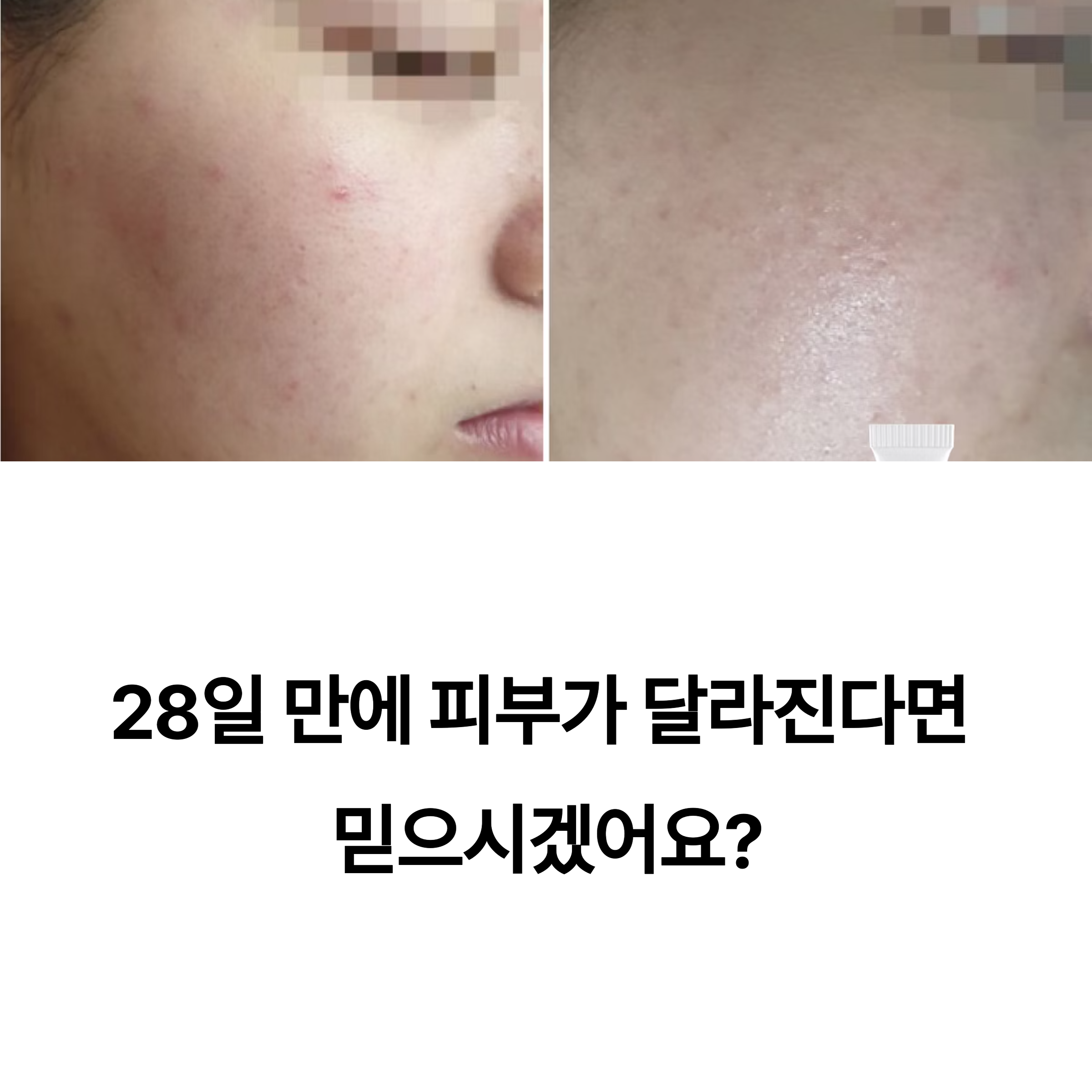 28일의 기적, 힉스테인 스킨커렉션 앰플과 크림 체험기