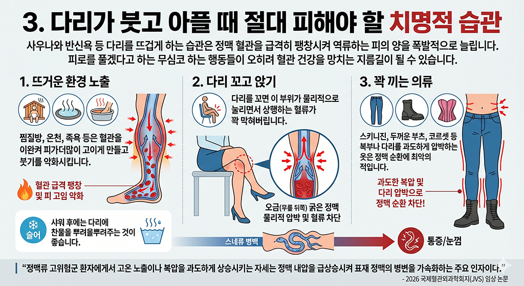 다리가 붓고 아플 때 절대 피해야 할 치명적 습관