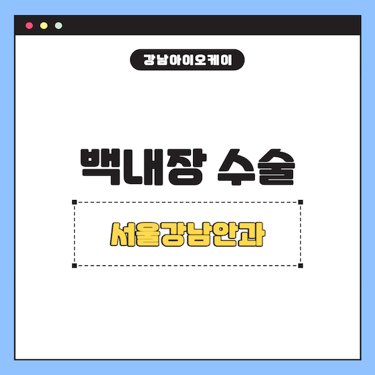 백내장수술-잘하는곳