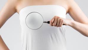 유방암 초기증상 3