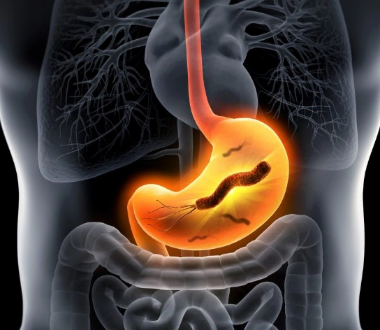 헬리코박터균 치료약 부작용