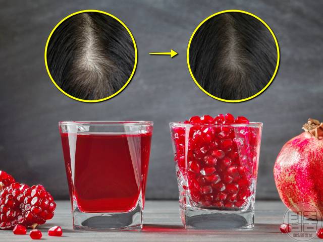 아이유 석류즙 효능 효과 탈모