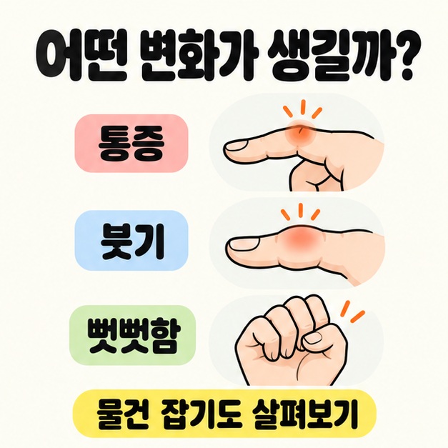 손가락 마디의 통증과 붓기, 주먹을 쥔 손의 뻣뻣함을 각각 그림으로 보여 주고 물건 잡기의 변화도 살피도록 안내한 도식