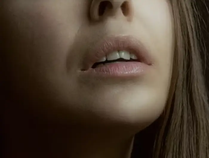 아시클로버 연고