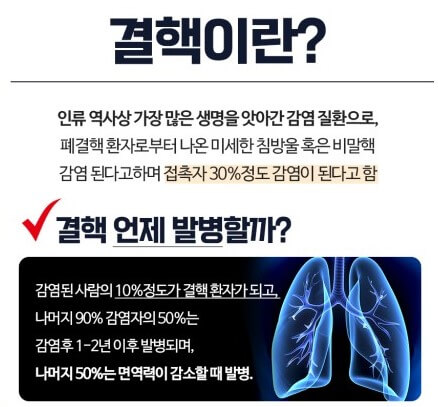 결핵