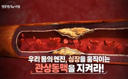 관상동맥