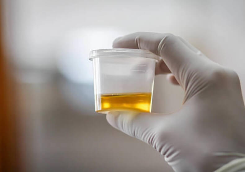 소변이잘나오지않는꿈