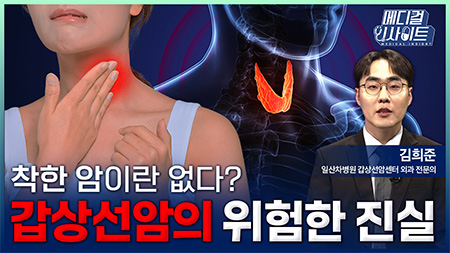 갑상선암의 위험한 진실