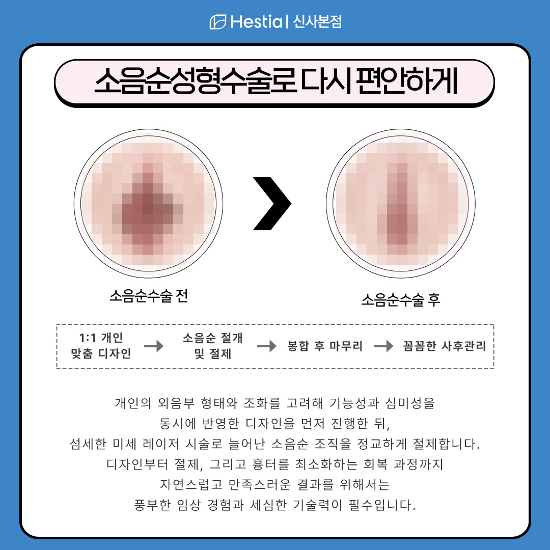 소음순성형수술을 통해 되돌릴 수 있습니다!