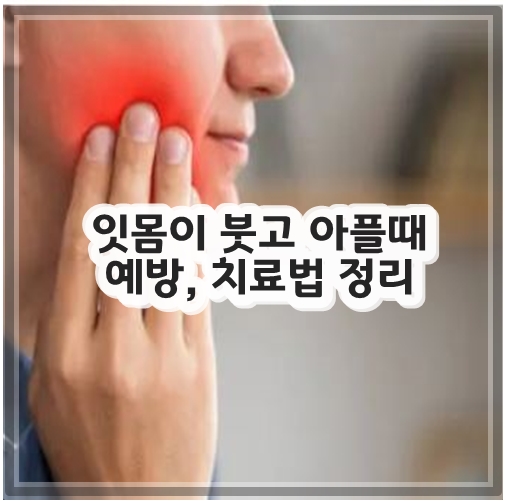 잇몸이 붓고 아플때 예방, 치료법 정리