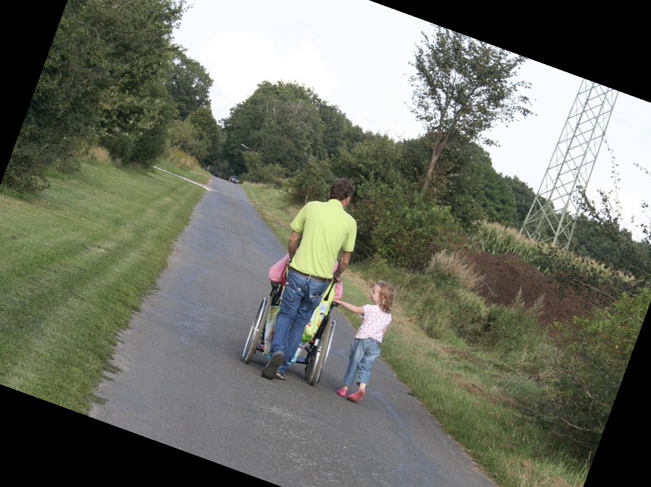 콘쥬란 주사 가격