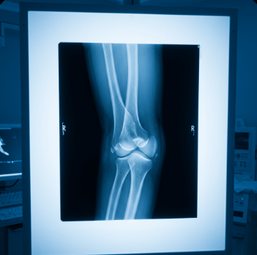 팔꿈치 통증 원인과 치료법8