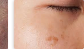 ๊ธฐ๋ฏธ ์์ ๋ ๋ฐฉ๋ฒ