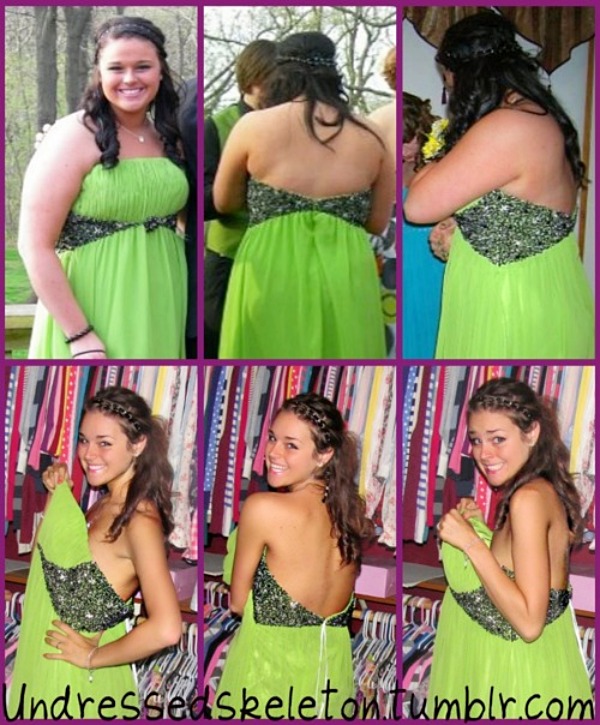 테럴린맥닛 다이어트 자극사진, 다이어트 성공후기, 성공기 성공비법, 비포애프터, 다이어트 팁줌 매일꿀정보