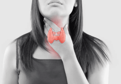 갑상선 기능 저하증 증상